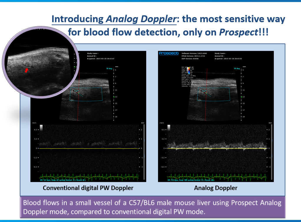 ProspectAnalogDoppler