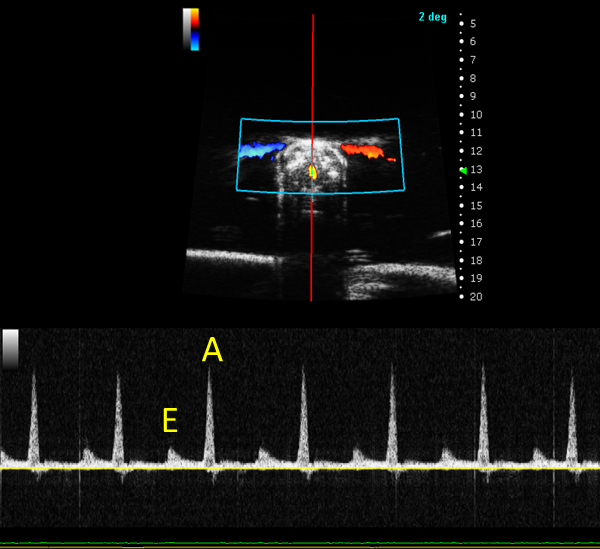 zebra_fish_ventricular_inflow_PW.png